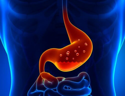 Low Stomach Acid – 6 Common Causes