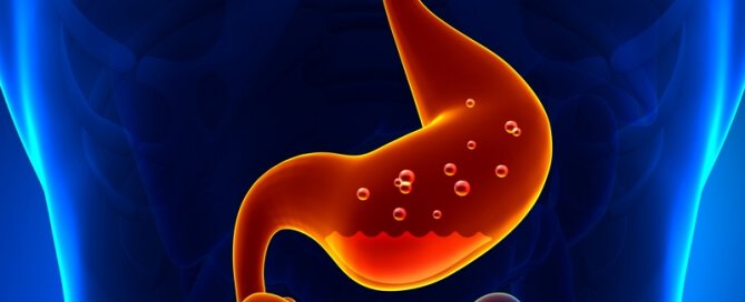 Low stomach acid and 6 common causes by Dr. Norm Robillard