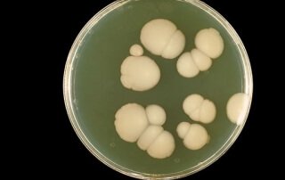 Dietary Control of Candida Overgrowth by Norm Robillard, Ph.D.