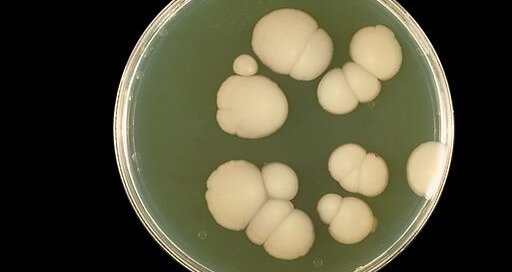 Dietary Control of Candida Overgrowth by Norm Robillard, Ph.D.