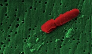 Fast Tract Diet Q&A - KLEBSIELLA and Red Potatoes 