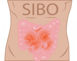 Dr. Norm Robillard - Consultation testimonials - SIBO