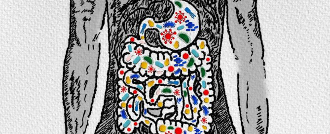 Are PPIs a Risk Factor for SIBO?