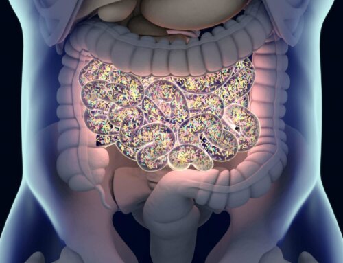 How to Fix SIBO and Prevent Recurrence