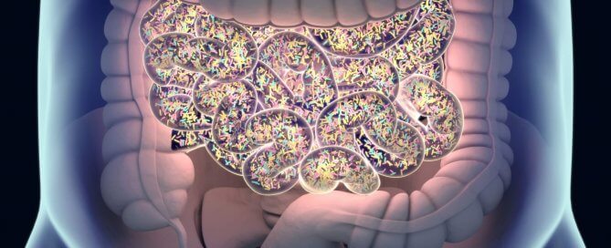 How to fix SIBO to prevent recurrence by Dr. Norm Robillard